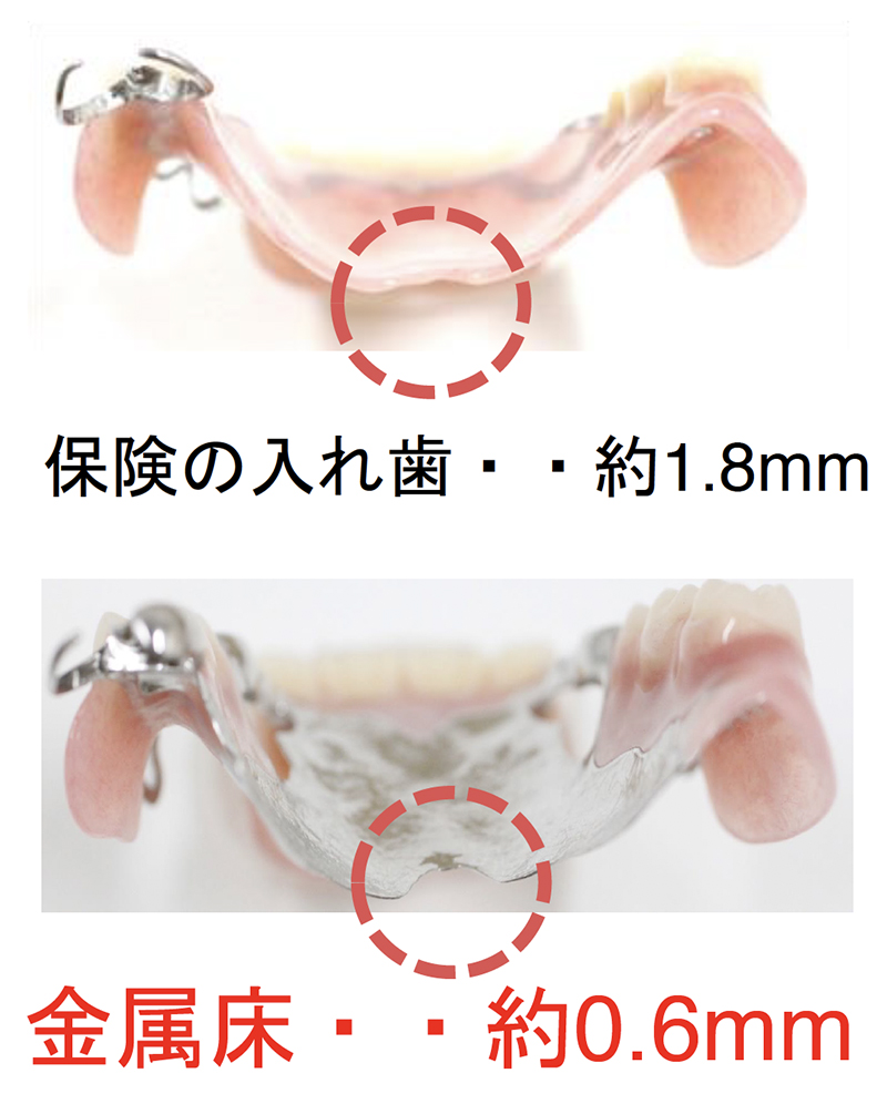 金属床の特徴