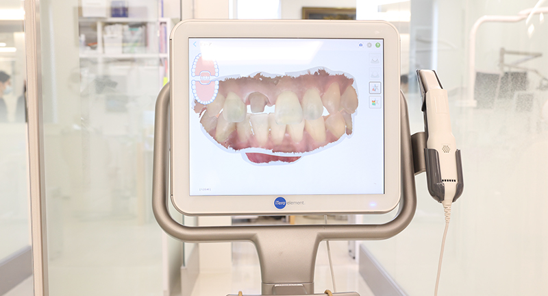 最新型3D光学スキャナー(iTero Element)を導入